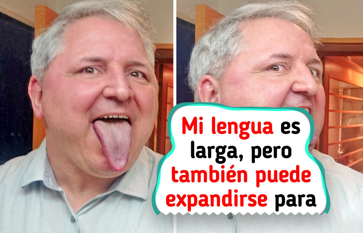 15 Rasgos inusuales del cuerpo humano que demuestran lo diversa que puede ser la naturaleza