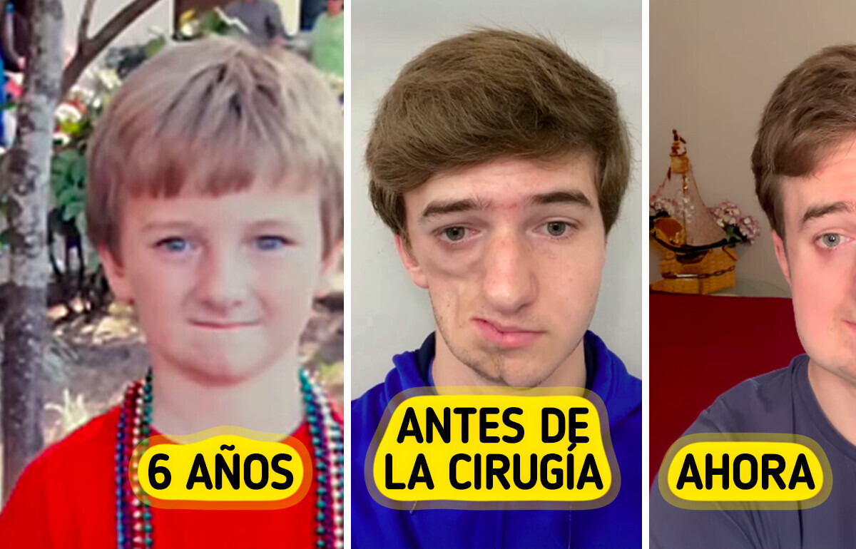La rara enfermedad de un joven lo convirtió en un héroe inesperado en Internet