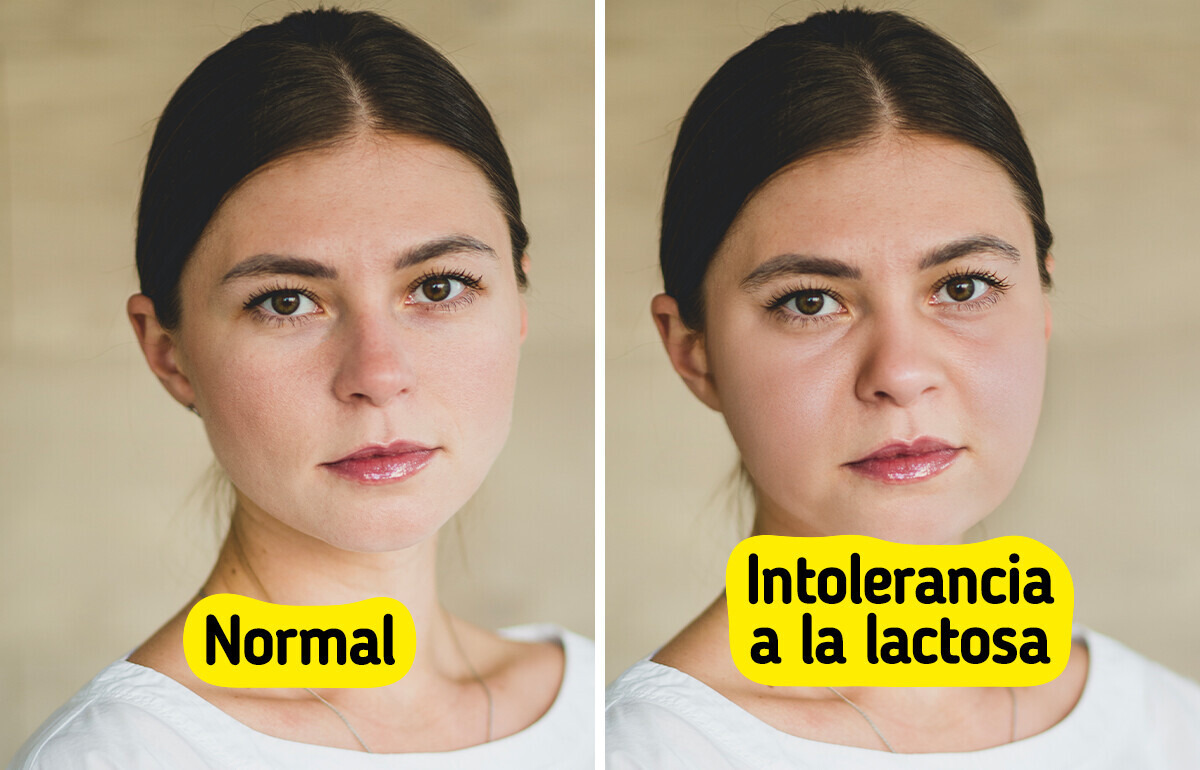 12 Señales que tu cuerpo podría estar enviando si eres intolerante a la lactosa