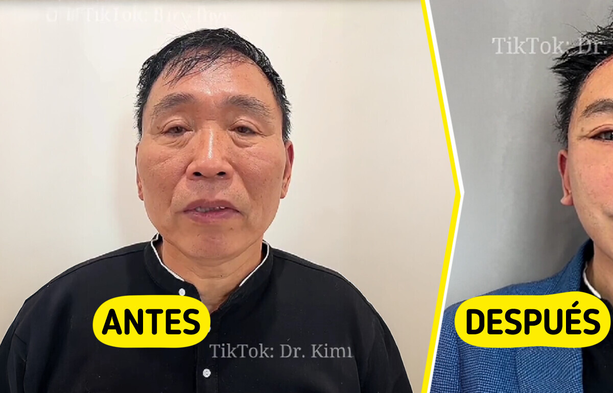 Los impactantes resultados de estas cirugías estéticas están dejando a todos entre el asombro y la crítica