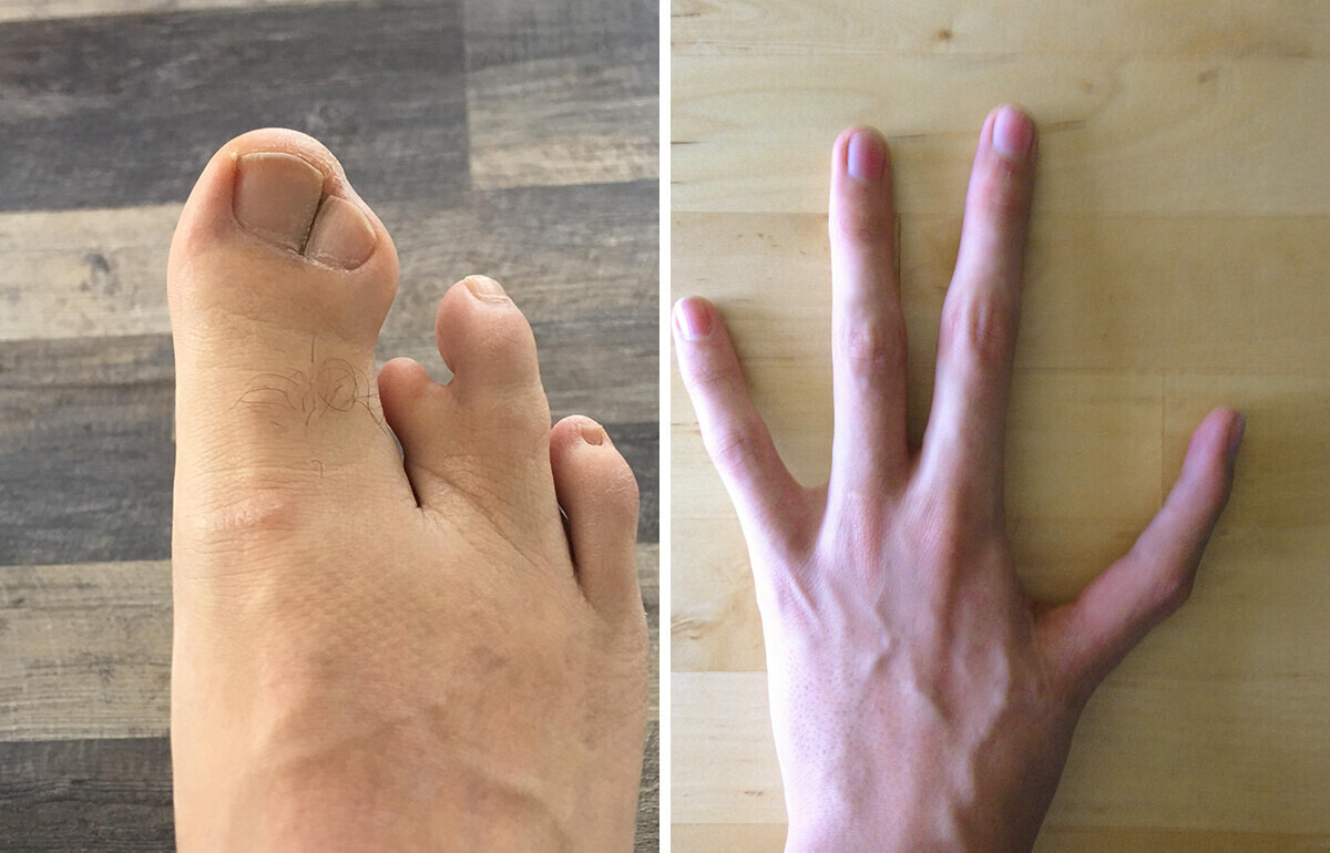 15 Historias sorprendentes de personas que vivieron experiencias corporales fuera de lo común