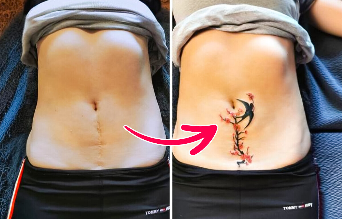 16 Artistas del tatuaje que transformaron las cicatrices en tatuajes excepcionales 16 Artistas del tatuaje que transformaron las cicatrices en tatuajes excepcionales