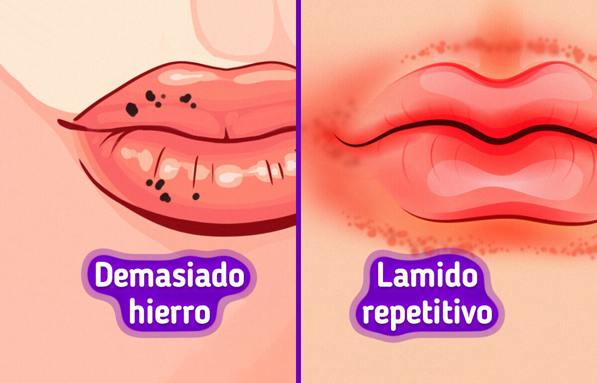 8 Cosas que tus labios podrían estar tratando de decir sobre tu salud