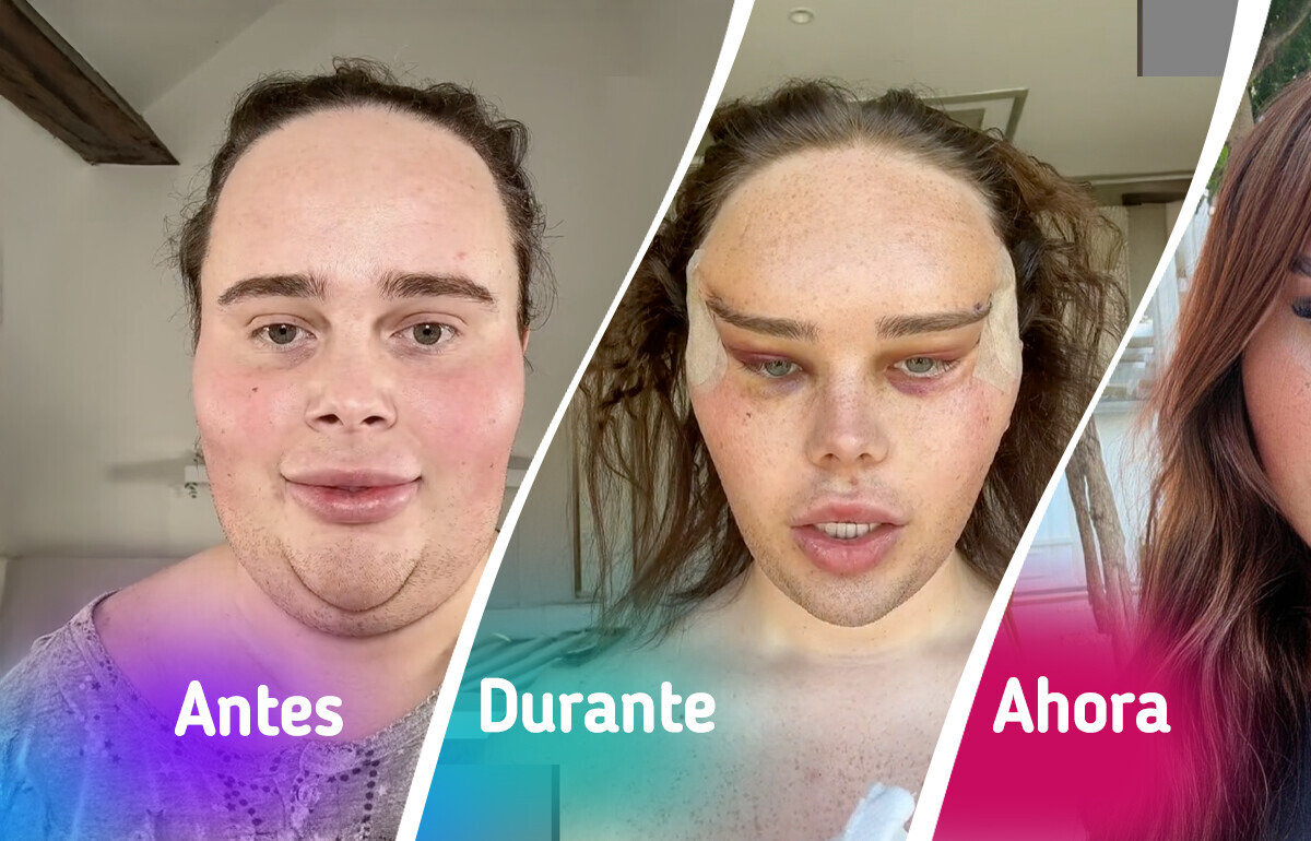“Así me convertí en quien siempre fui”: su cirugía de ojos cambió más que su rostro “Así me convertí en quien siempre fui”: su cirugía de ojos cambió más que su rostro