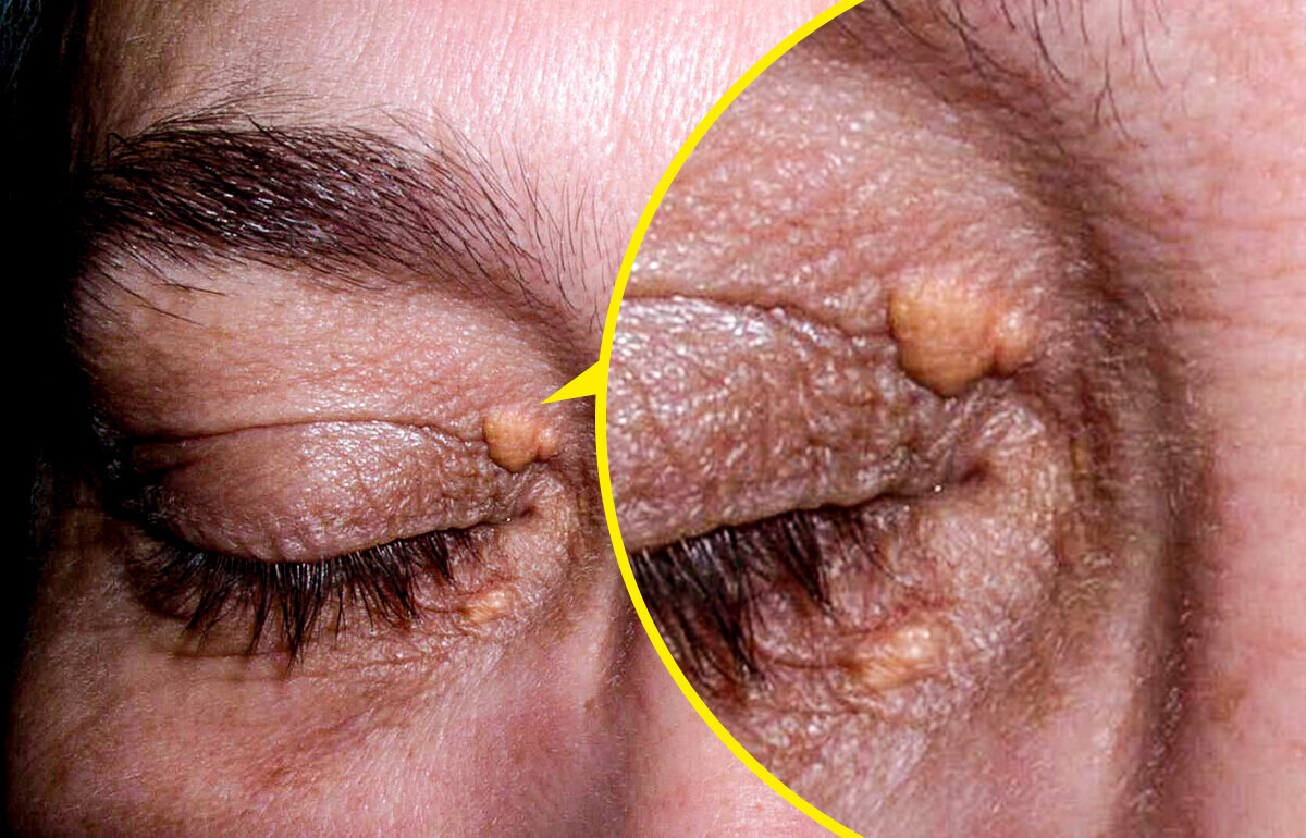 5 Detalles en tu rostro que puedes pasar por alto, y dicen mucho de tu salud