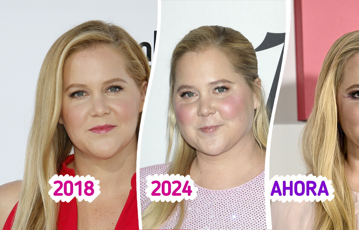 Así fue como Amy Schumer descubrió su problema de salud gracias a comentarios en redes