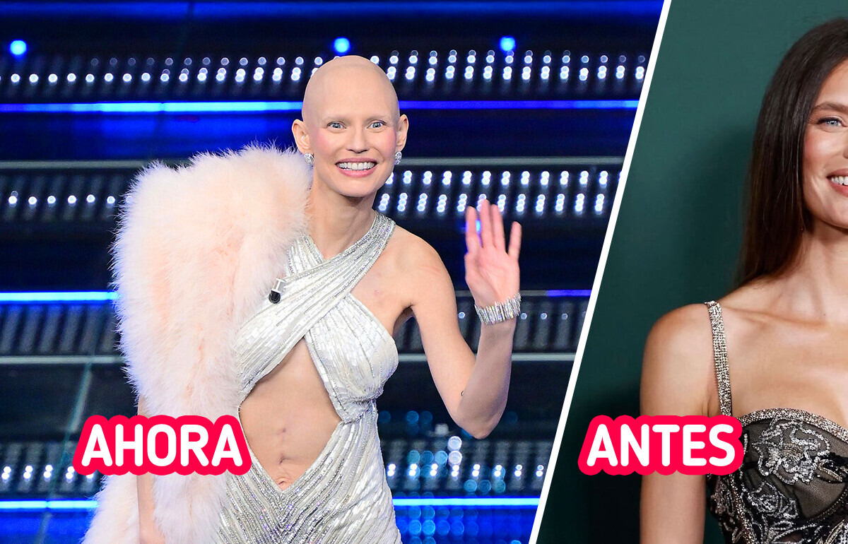Modelo de Victoria’s Secret conmueve al revelar su cabeza sin cabello y una cicatriz