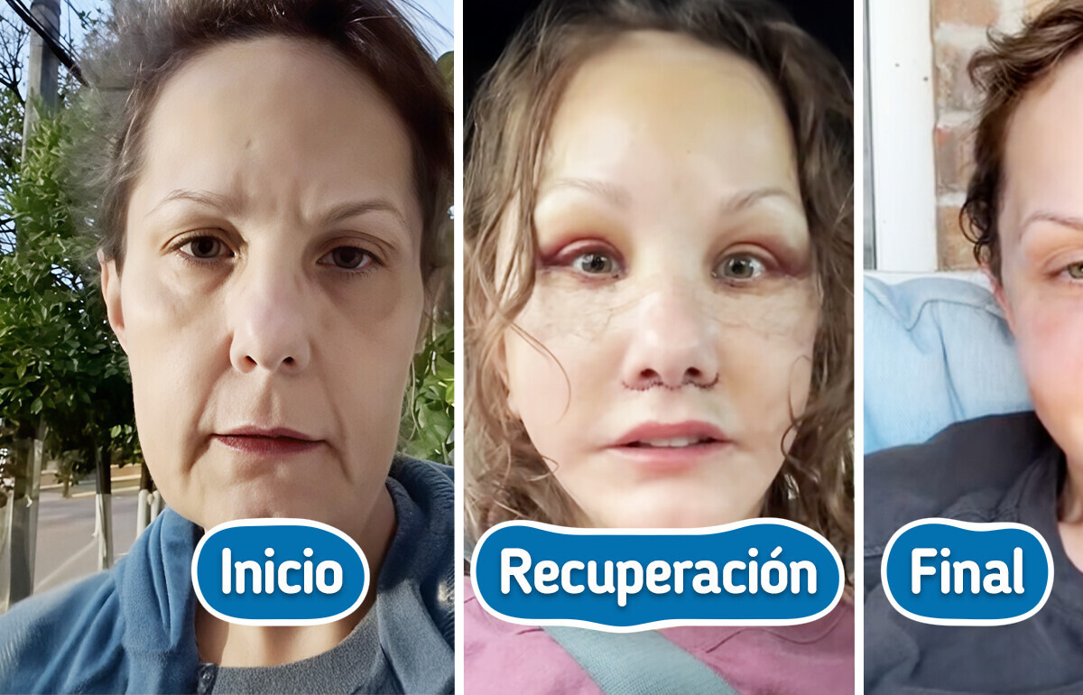Su transformación fue tan radical que todos se sorprenden cuando dice su verdadera edad