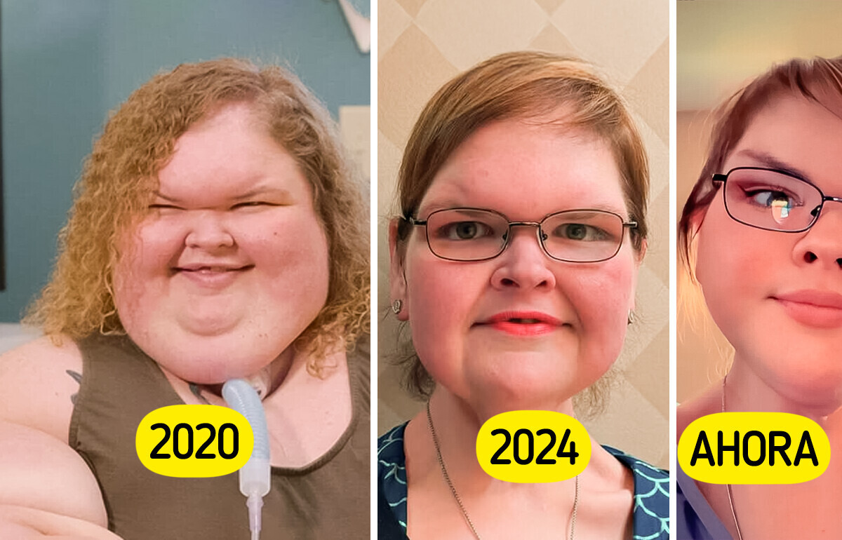 La emotiva transformación de Tammy: de temerle al espejo a brillar con orgullo