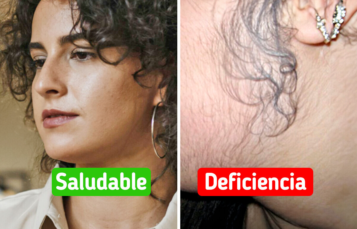 5 Pistas que tu cuerpo da cuando necesita más vitamina D