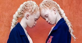 Hace un año, estas gemelas extraordinarias se convirtieron en una sensación de Internet. Mira cómo se ven ahora