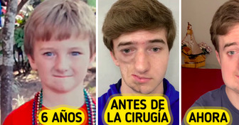 La rara enfermedad de un joven lo convirtió en un héroe inesperado en Internet