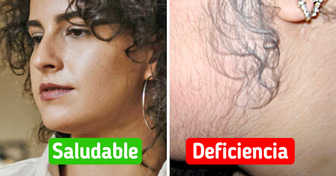 5 Pistas que tu cuerpo da cuando necesita más vitamina D