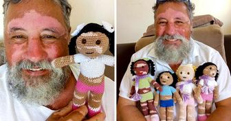 Un abuelo con vitíligo teje muñecas para devolverles la autoestima a los niños que sufren de esta enfermedad