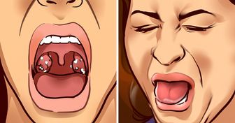 9 Cosas que pueden provocarte un mal sabor en la boca