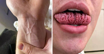 18 Pruebas de que la genética puede sorprendernos de formas increíbles