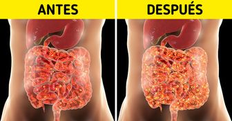 Qué puede sucederle a tu intestino si comes aguacate todos los días