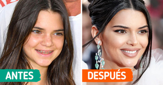 14 Sonrisas de famosos antes y después de usar brackets