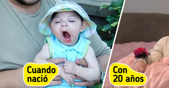 Nació sin cerebro y los médicos no le daban esperanza: hoy celebra 20 años