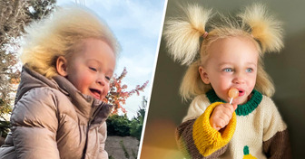 Pequeña de 2 años con síndrome de pelo indomable se vuelve viral por su hermosa y rebelde cabellera