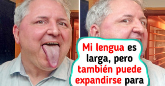 15 Rasgos inusuales del cuerpo humano que demuestran lo diversa que puede ser la naturaleza