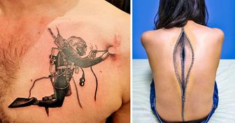 Los tatuajes pueden trasformar las cicatrices en obras de arte que nadie querrá volver a ocultar