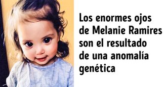 15 Personas que se hicieron famosas gracias a su aspecto físico único