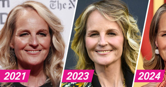 Helen Hunt reaparece con un detalle en su rostro, que ha hecho que todos generen comentarios