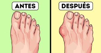 10 Razones para deshacerte de tus chanclas ahora mismo por el bien de tu salud