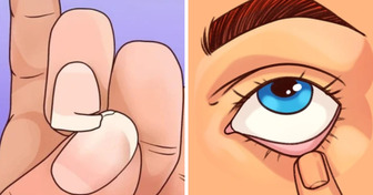 10+ Formas en que el cuerpo avisa que podría tener deficiencia de hierro
