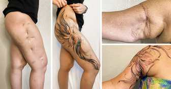 Artista tatúa cicatrices para que las personas puedan presumir lo que antes ocultaban
