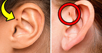 Tus orejas pueden revelar cuán raro eres + 10 características corporales únicas