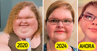 La emotiva transformación de Tammy: de temerle al espejo a brillar con orgullo