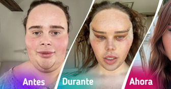 “Así me convertí en quien siempre fui”: su cirugía de ojos cambió más que su rostro