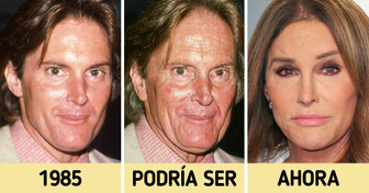 Cómo se verían 8 famosos si nunca hubieran probado los procedimientos cosméticos modernos