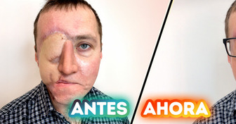 Una artista convierte el dolor en arte con un tatuaje hiperrealista de un ojo para un superviviente de un accidente de tráfico