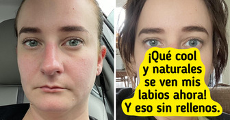 15 Conmovedores antes y después de personas que celebran sus asombrosos cambios