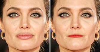 17 Fotos que demuestran que un retoque en los labios puede cambiar el rostro completamente