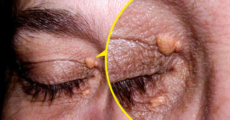 5 Detalles en tu rostro que puedes pasar por alto, y dicen mucho de tu salud
