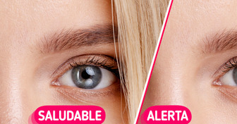 5 Señales en tu rostro que podrían advertir sobre problemas de salud ocultos