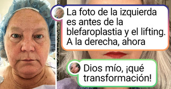 18 Mujeres que se arriesgaron a acudir a expertos en belleza revelaron cómo cambió su aspecto