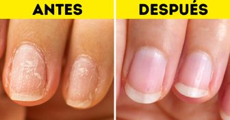 10 Remedios caseros que pueden hacer maravillas en tus uñas