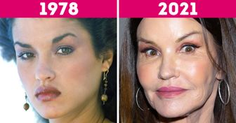 20 Pares de fotos que muestran cómo han cambiado los rostros de las supermodelos con el paso del tiempo