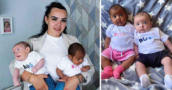 Desafió a la genética: Madre dio a luz a gemelos con tonos de piel totalmente distintos