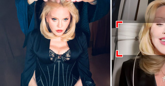 Madonna muestra sus nuevos dientes y todos notan lo mismo