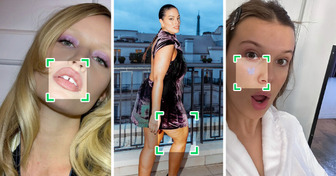 10 “Imperfecciones” físicas que los jóvenes transformaron en tendencia