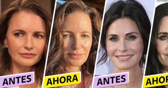 5 Famosas que se quitaron los rellenos faciales y les encantó el resultado