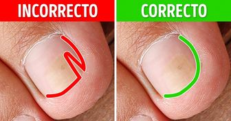 9 Formas efectivas de arreglar las uñas encarnadas en los dedos de los pies
