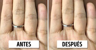 5 Trucos de cuidado de la piel para manos secas que funcionan de maravilla