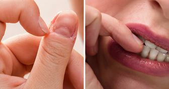5 Cosas que tu hábito de morderte las uñas puede revelar sobre ti